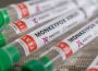 India confirms its first monkeypox death - beyond Ladakh - indusdispatch.in
